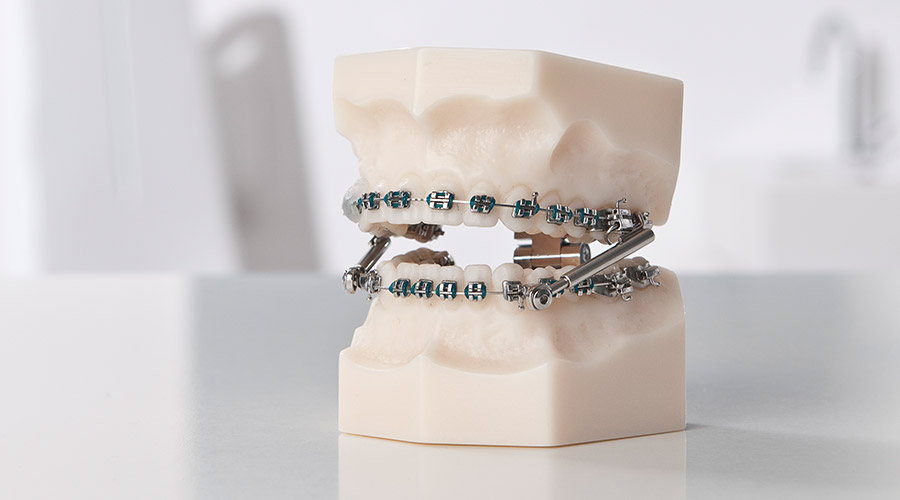 Non-Compliance-Geräte